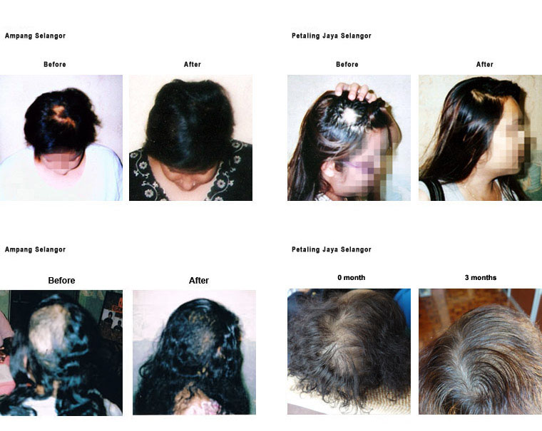 Testimonials Hair Treatment