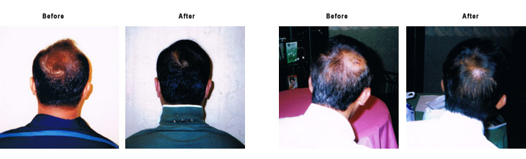 Testimonials Hair Treatment